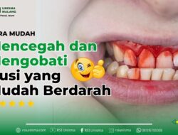 Mengenali Perbedaan Gusi Berdarah Ringan dan Serius: Panduan Lengkap untuk Kesehatan Mulut Optimal