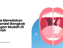 Apa Penyebab Amandel Bengkak Tanpa Demam? Ini Penjelasan Medis Lengkapnya