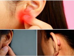 Kenapa Daun Telinga Berwarna Merah dan Terasa Panas? Ini Penyebab dan Solusinya