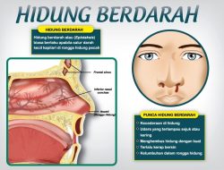 Memahami Kenapa Hidung Mudah Berdarah saat Mengeluarkan Ingus dan Cara Mengatasinya
