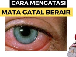 Mengapa Mata Berair dan Gatal Saat Berdebu? Penyebab, Gejala, dan Cara Mengatasinya