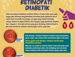 Mengapa Penderita Diabetes Rentan Mengalami Rabun Mata? Penjelasan Medis dan Cara Mencegahnya