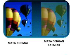 Mengapa Penglihatan Buram di Sore Hari? Memahami Penyebab, Gejala, dan Solusinya