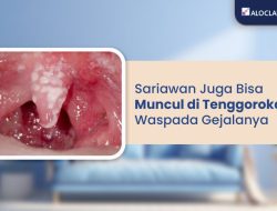 Mengenal Penyebab Sariawan di Dinding Tenggorokan dan Cara Mengatasinya