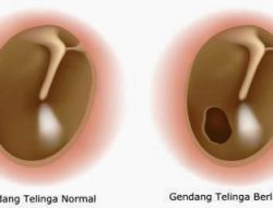 Mengenal Perforasi Membran Timpani: Bagaimana Cara Mengetahui Apakah Gendang Telinga Bocor dan Langkah Penanganannya