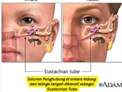 Panduan Lengkap Cara Mengatasi Telinga dan Hidung Tersumbat Bersamaan