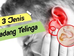Panduan Medis: Bagaimana Cara Membedakan Radang Telinga Tengah dan Luar secara Tepat