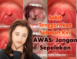 Penyebab Tenggorokan Sakit Saat Bangun Pagi dan Cara Mengatasinya