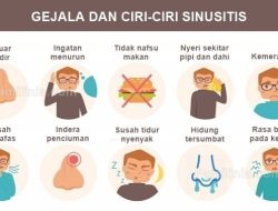Perbedaan Gejala Sinusitis dan Migren Mata: Panduan Medis Lengkap